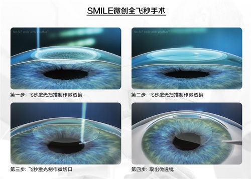 眼科謠言，你的“好心轉(zhuǎn)載”辦了多少壞事